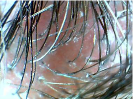 Hair and scalp after treatment