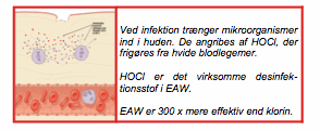 EAW virkem&aring;de