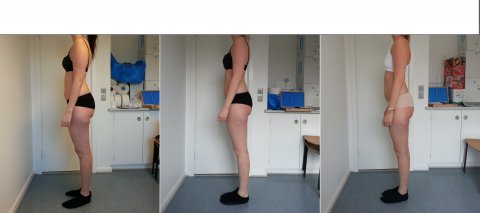 Anne - opstramning