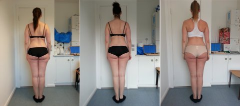 Anne - opstramning